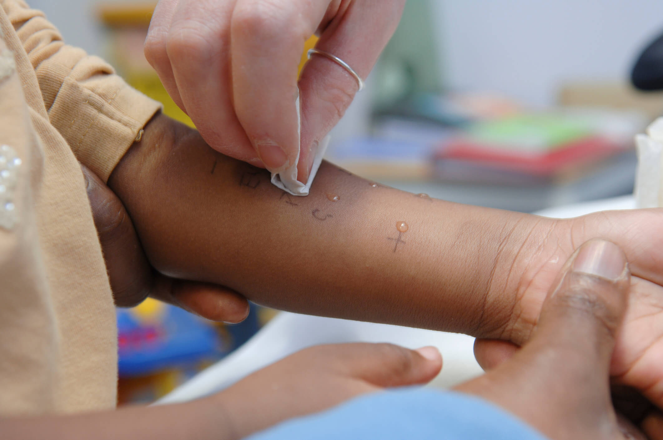 Medical professional administering an allergy test to a patients forearm